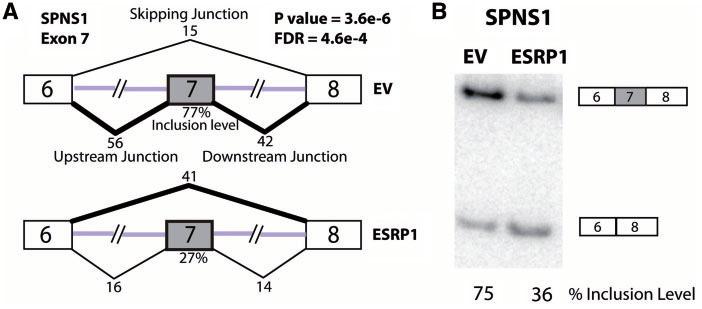 10 Nucleic Acids Research, 2012 Figure 6. RNA-Seq and RT PCR analysis of SPNS1 exon 7 splicing. (A) RNA-Seq junction counts and MATS result of SPNS1 exon 7 in the EV and ESRP1 samples.