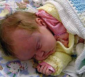 We didn t know Ella had spina bifida and hydrocephalus until the day she was born. At that point we felt like our world had collapsed. We were scared, worried and couldn t stop crying.