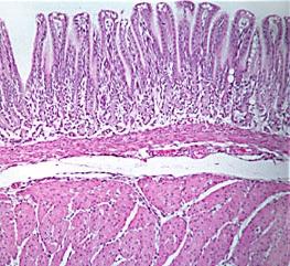 Stomach Pylorus mucosa Gastric pits