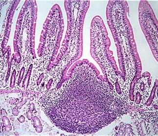 The Duodenum BG L Goblet cells and villi confirm