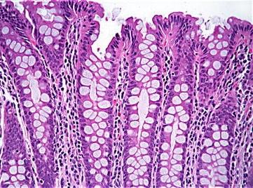 Goblet Cells in the Colon Mucus from the numerous goblet cells is used