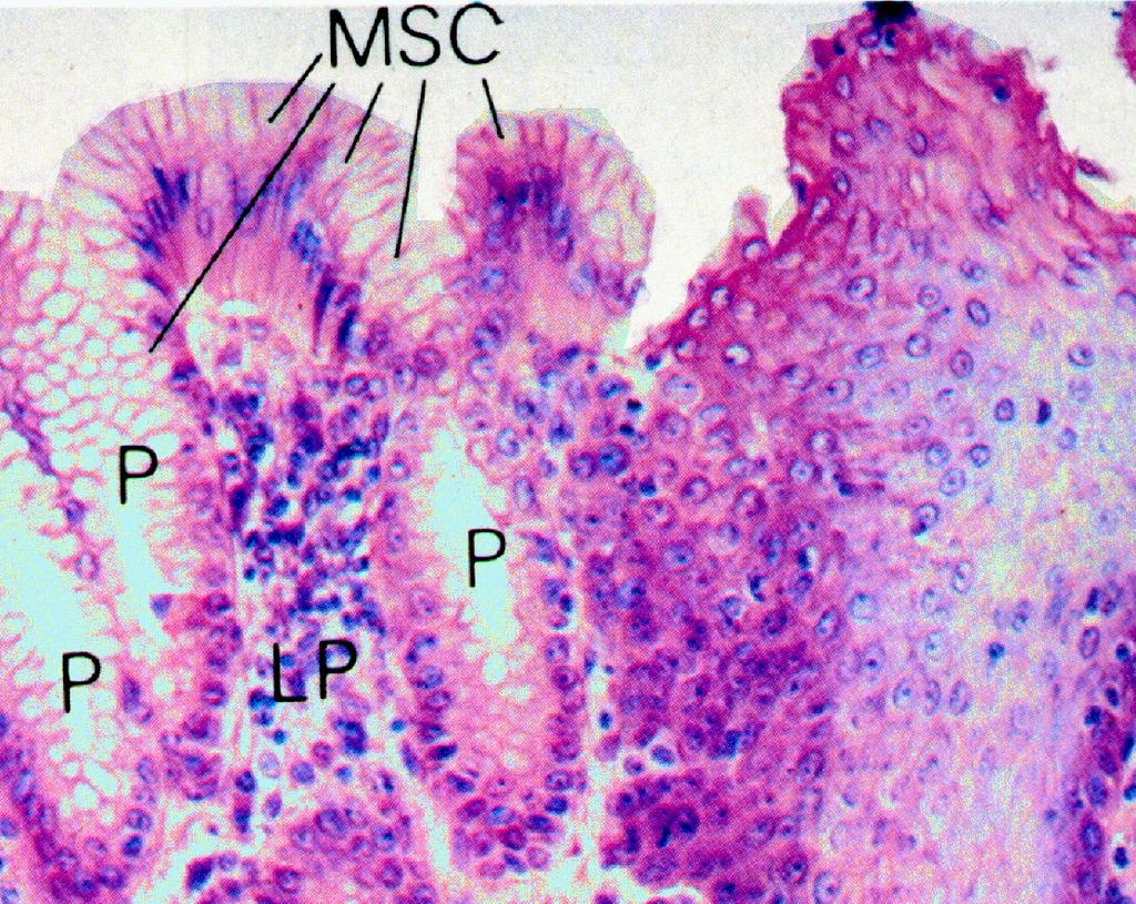 Gastroesophageal Junction mucus surface cells