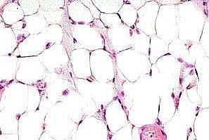 vacuole which in the live cell contains
