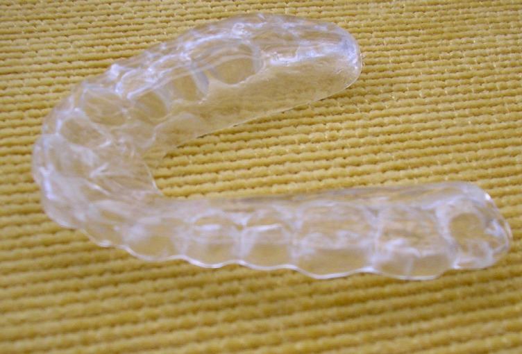 Pinnacle Medicine & Medical Sciences ISSN: 2360-9516 Page 4 The first proposal was a superior and inferior miorelaxing acrylic mouth guard to stabilize the muscles and to contain the orthodontic