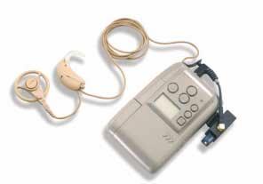 What is a cochlear implant? A cochlear implant system has two parts. One part is worn like a hearing aid, the other is surgically implanted.