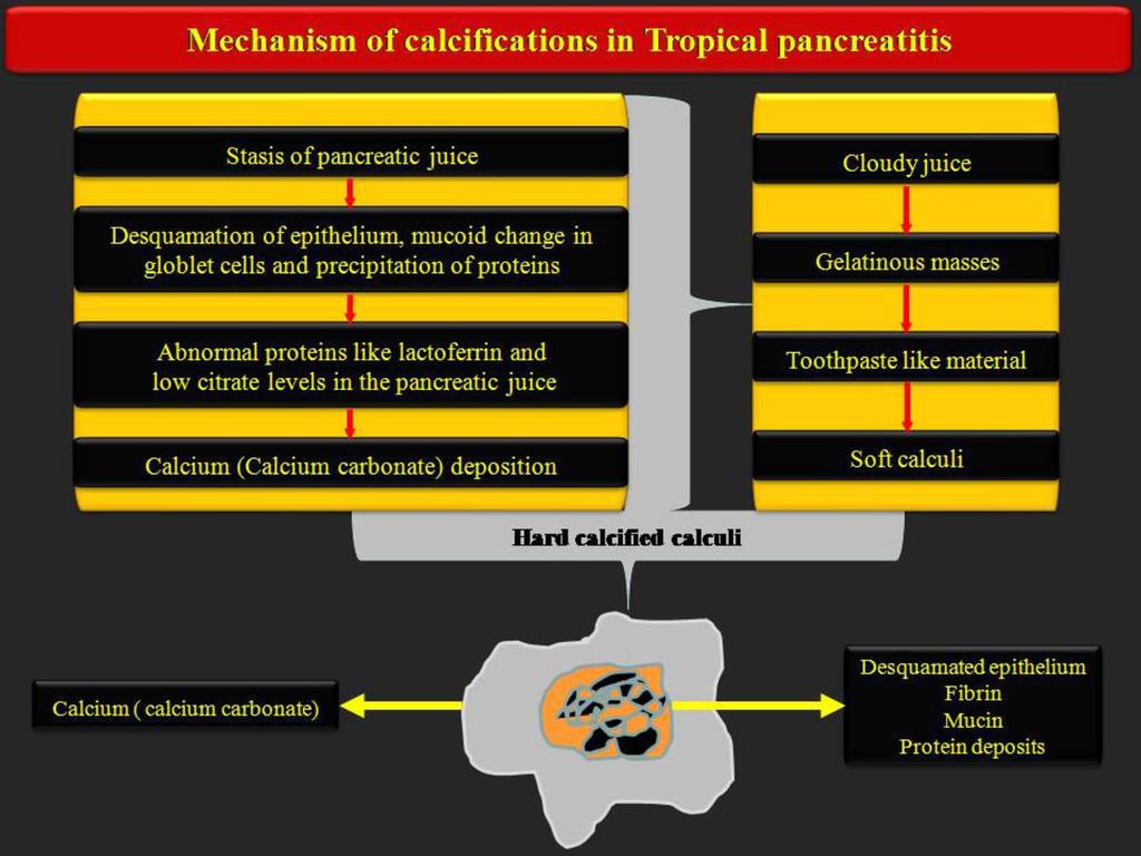 Fig. 4: Mechanism of stone formation in Tropical Chronic Pancreatitis