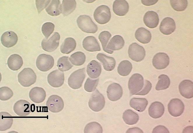 Parasitaemia > 2% of red blood cells infected = alert Staff (training & expertise) Off-hours Aantal Gevallen 3,5 3 2,5 2 1,5 1 0,5 0 1984 Gemiddeld aantal malariagevalllen per laboratorium