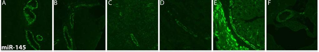 Supplementary Figure 5. Expression of mir-145 in human and murine smooth muscle of blood vessels and murine colonic myoepithelia.
