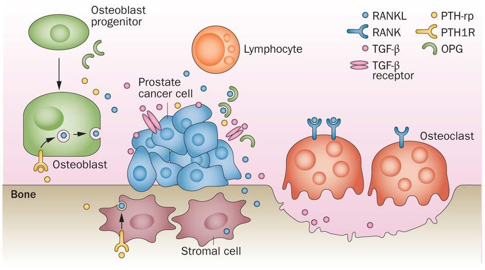The vicious cycle of bone metastases 1. Sources of RANKL include osteoblasts, stromal cells and T lymphocytes. 2.