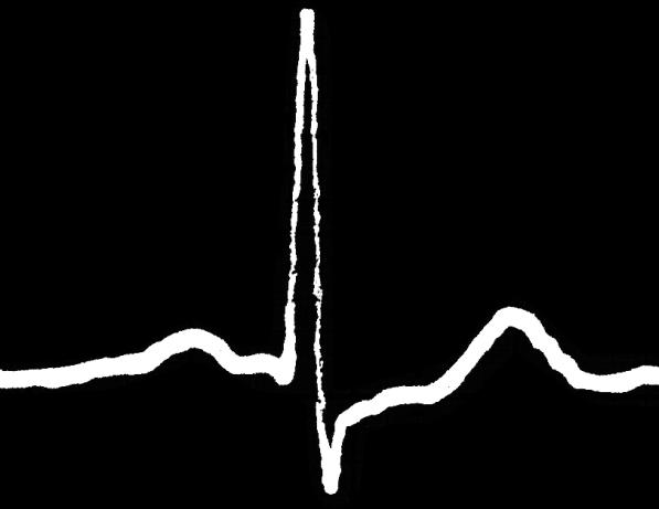 fibers P wave QRS complex T wave Electrical events (heart muscle excitement)