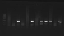 Results - Nested PCR results in lung infected patient 269 bp Lane 1: Marker