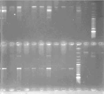 802 pb 179 pb Figure 1 - Agarose gel stained with ethidium bromide showing the 802bp fragment of the RdRp gene of turkey astrovirus (TAstV) of the eight TAstV- positive samples found in the present