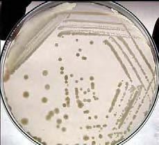 code product name application/description gm/lit unit unit price old/new ` PM 019 Pseudomonas Isolation For the isolation and cultivation 45.02 100 gms 608.