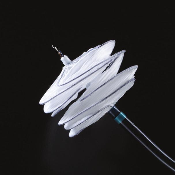 Nonsurgical closure of atrial septal defects The ASD closure device is released from the catheter, and left in the heart, preventing the abnormal flow of blood between the two chambers.