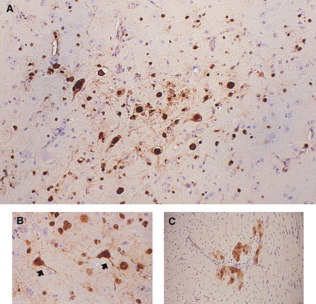 VOL. 73, 1999 BIOLOGICAL HETEROGENEITY OF H5N1 INFLUENZA A VIRUS 3187 FIG. 1. Immunohistochemical analysis of mice infected with a mouse-pathogenic Hong Kong H5N1 virus.