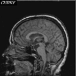 Depth in the Brain (mm) - 8 0-6 0-4 0-2 0 0 100 80 60 40 2 0 0 TMS-induced electrical field c e n t r a l s u l c u s