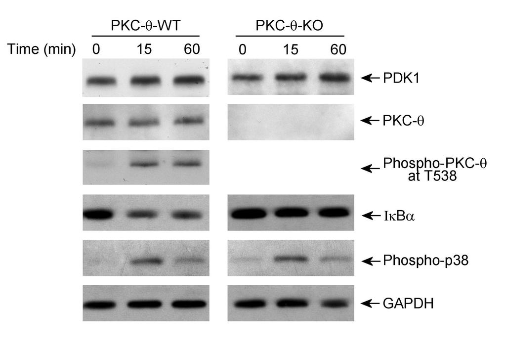 Supplementary Figure 1 CD4 + T cells from PKC-θ null mice are defective in NF-κB activation during T cell receptor signaling.