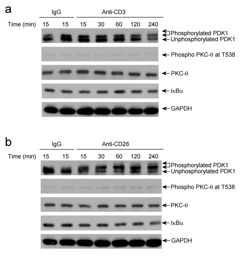 Supplementary Figure 10 Coligation of CD3 and CD28 is required for activation loop phosphorylation of PKC-θ θ and Iκ κbα α degradation.