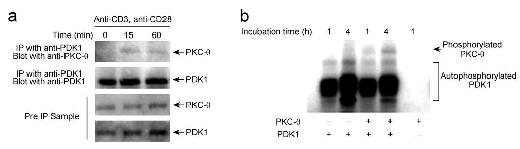 Supplementary Figure 9 PDK1 binds to PKC-θ in primary T cell upon antigen receptor stimulation and phosphorylates PKC-θ in vitro.