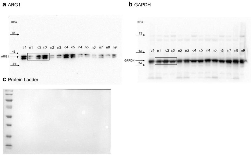 Supplementary Figure 13. Full scan of the original uncropped western blot. Original Western blots used in Fig. 4e.