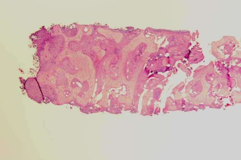 This show the histology of the coronal portion of the core sample. The alveolar crest is on the left.