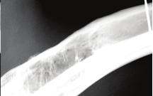 a Collagen-Anorganic Bone Composite for Bone Repair: Part II: In Vivo