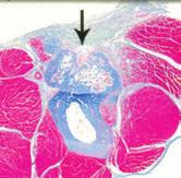 B D Figure 3A: Histology of Radius A) Intact radius, no defect, B) OssiMend in place at day 0 C)