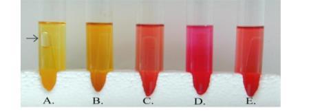 Identification: Metabolic Tests Phenol red broth Allows determination of carbon source preferred and metabolism (Oxidation or fermentation) Contains simple carbon sources: Peptone (protein amino