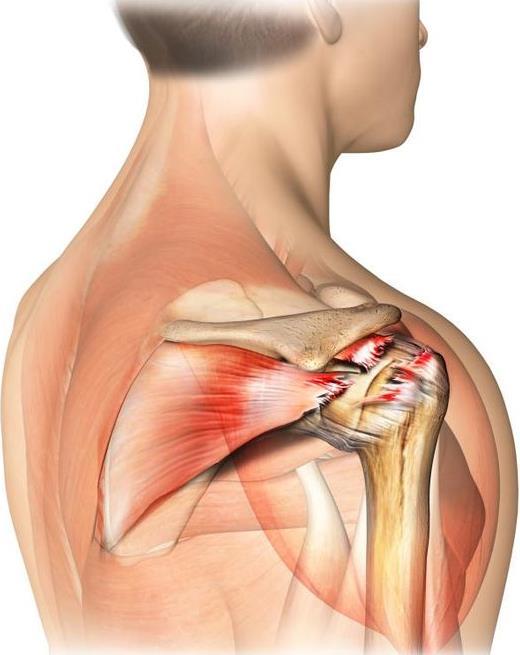 What is the Rotator Cuff? All About the Rotator Cuff The Rotator Cuff is four muscles that attach to the ball of the shoulder (humeral head).