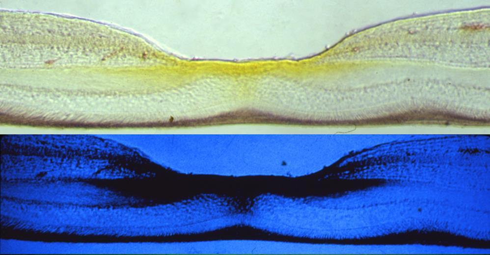 Comprise Macular Pigment Viewed in white