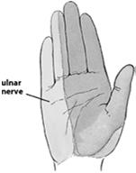 will specifically state it s the small finger or small and ring fingers Often patients