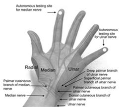 symptoms Cubital Tunnel Syndrome Exam