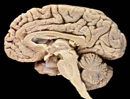 Brain Structures Brainstem: *Pons Function/s *Medulla Oblongata *Midbrain -Corpora Quadrigemina Cranial Nerves: *Olfactory Bulb or Nerve *Optic Nerve -Optic Chiasma *Trigeminal Nerve Diencephalon: