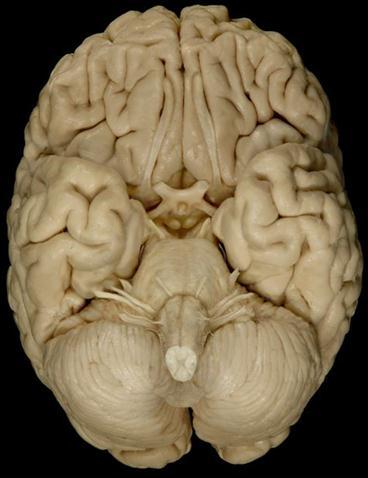 PART 5 Inferior View of the Human Brain A) Click at the CHANGE TOPIC button on the left side of the screen. From the Select Topic, select Brain and then from the Select view select Inferior.