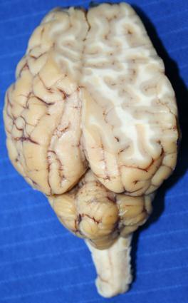 With the anterior portion of the sheep s brain on the dissecting tray, CAREFULLY remove a slice from the parietal lobe using the scapel.