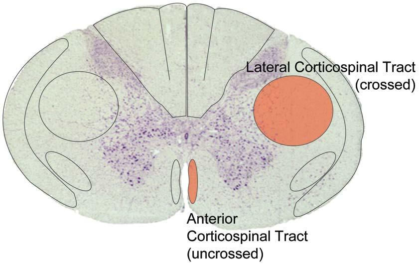 Spinal Cord Review Tracts of descending axons carrying motor information from