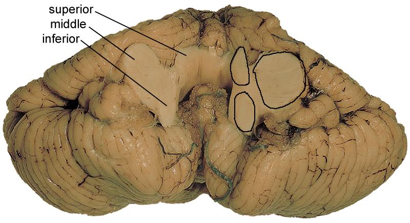 Pons Superior, middle and inferior cerebellar
