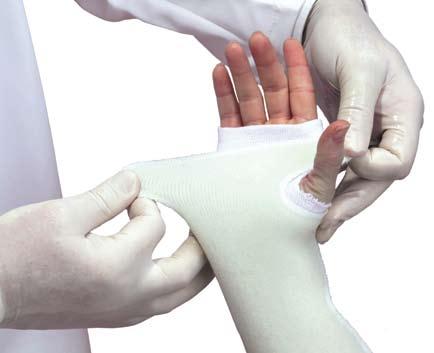 Plus, Techform Functional Splints will cover twice the anatomy compared to a traditional rectangular shaped splint.