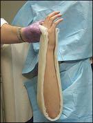REDUCTION AND SPLINTING
