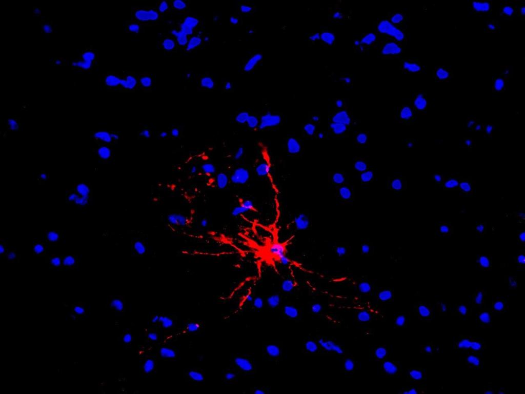 Identification of cell populations expressing A20 in the CNS A20/DAPI NAWM 25 µm PPMS