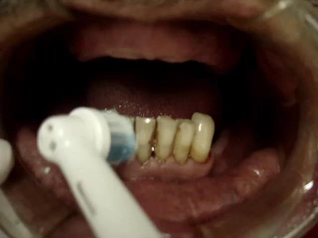 way of keeping good oral