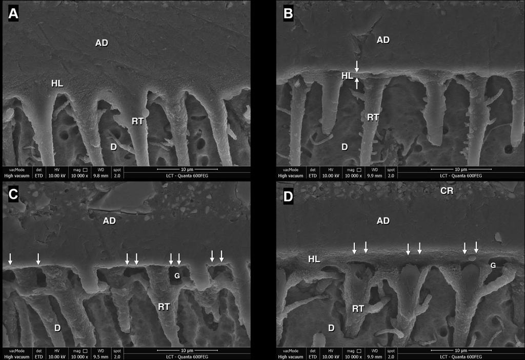 Figure 15 Representative FE-SEM images of resin-dentin interfaces produced by four adhesives applied on etch-and-rinse mode to over dried dentin.