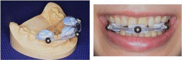 Methods The ManMoS uniquely integrates the virtual dentoskeletal model with the real motion of the dental cast mounted on the simulator, generating the mixed-reality surgical simulation.