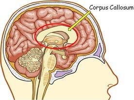 The Graphic Narrative Creating a Corpus Callosum Bypass (Tinnin, 2010) Responsible for transmitting neural messages between the left and right hemispheres. Images created in the graphic narrative.