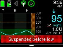 * Clinical evidence and real-world data show 75-97% of lows were avoided using Suspend before low * *Choudhary P, Olsen B,