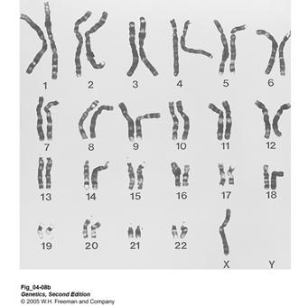 XO: female Turner s Syndrome 1/3000 female births XXY Male Klinefelter Syndrome: 1/1000 male births Less commonly: XXXY or XXXXY or XXYY Role of Sex Chromosomes in