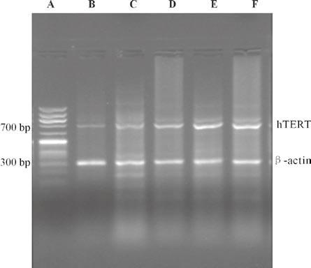 Life Science Journal, Vol 4, No 3, 2007 http://lsj.zzu.edu.cn 3.4 Detection of htert mrna expression in transfected RT-PCR results showed that the amplification product of β-actin (confer) was 315 bp.