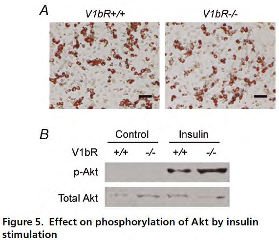 Blood glucose (mg/dl) 12 1 8 6 4 2 WT (16) V1aR-KO (2) V1bR-KO (25) Increased insulin sensitivity in V1bR-KO mice GTT ITT V1bR+/+ V1bR-/- V1bR+/+ V1bR-/-