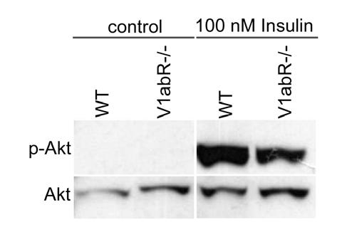 Decreased phosphorylation of Akt by the insulin