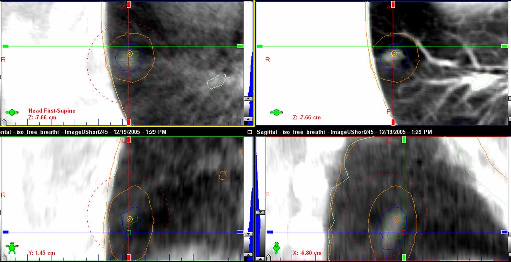 CBCT images prior